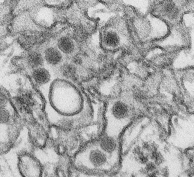 O vírus da zika. Cientistas provaram presença em pernilongos
