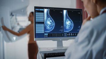 PARAPUA-SP METROPOE MAMOGRAFIA 12-09-2022 Departamento de Saúde divulga atendimentos de mamografia realizados até o mês de setembro. FOTO PREFEITURA PARAPUA. Foto: DIV