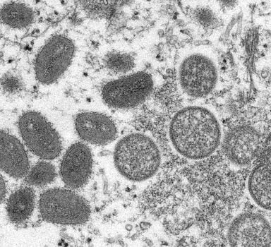 Imagem de microscópio eletrônico mostra sinais da varíola dos macacos em uma amostra de pele humana