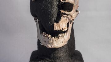 Crânio do homem antigo Vittrup. Foto: Stephen Freiheit/PLOS One