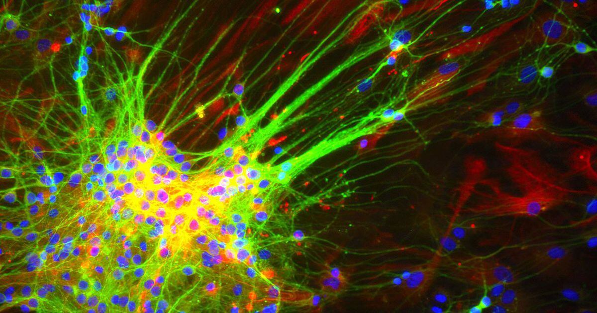 Neuronas que revierten la parálisis
