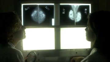 Médicos observam mamografia. Foto: Tasso Marcelo/Estadão