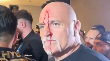 John Fury com sangue na testa. Foto: Reprodução Box Nation TV via X