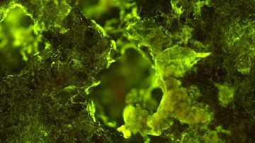 Visão microscópica da bactéria Sphingomonas desiccabilis crescendo no basalto. Foto: Rosa Santomartino University of Edinburgh via The New York Times