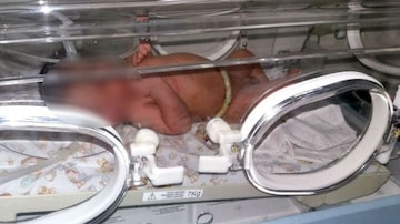 A criança foi levada para a Santa Casa de Macatuba e colocada numa incubadora. Foto: Polícia Militar de Macatuba
