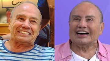 Stenio Garcia antes e depois da harmonização facial. Foto: ESQ: Reprodução/Instagram: @oficialsteniogarcia / DIR: Reprodução/SBT