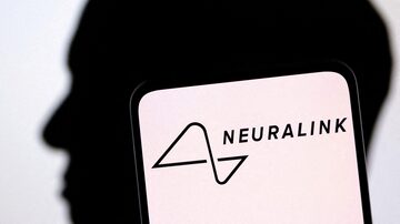 Neuralink realizou o primeiro implante em humanos com sucesso 