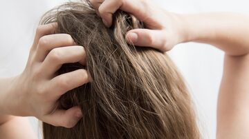 Closeup woman hand itchy scalp, Hair care concept. Foto: HappyHaus/Adobe Stock      