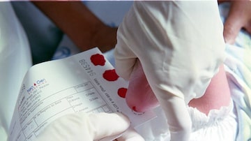 O Teste do Pezinho é um dos métodos usados para diagnosticar doenças raras. Foto: Heitor Hui/Agência Estado. Foto: Heitor Hui / Agência Estado