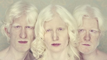 Gustavo Lacerda passou cinco anos fotografando albinos. Foto: Gustavo Lacerda/Divulgação