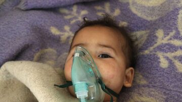 Diversas crianças ficaram feridas após um suposto ataque químico no norte da Síria. Foto: AFP PHOTO / Mohamed al-Bakour