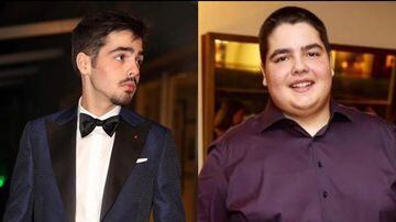 O depois e o antes de João Silva. Foto: Reprodução/Instagram @joaosilva 
